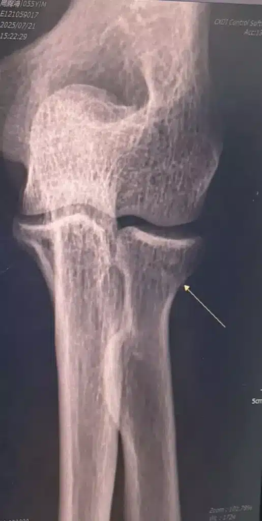 AnyConv.com S 10141707